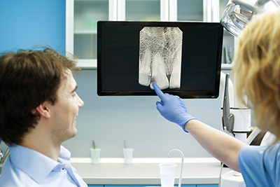 Signs That You Need Dental X-Rays